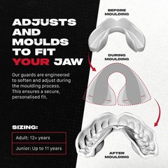 SAFEJAWZ Mouth Guard, Slim Fit Mouthguard for Adults Adult (12+ Years), Black
