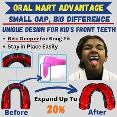 Youth Sports Mouth Guard for Kids (USA Flag, Fangs, 20+ Colors to Choose From) M