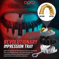 OPRO Instant Custom-Fit Mouth Guard, Adult (10+), Ufc Strike – Gold/White
