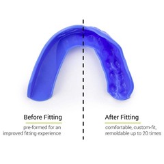 SISU Sports Mouth Guard 3D 2.0mm | Easy-to-Fit, Custom Fit Mouth Guard | MaxStra