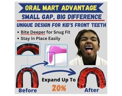Oral Mart Black/Green Youth Mouthguard for Kids – Karate, Flag Football, MMA