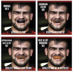 Shurfit Custom Fit Mouth Guard Boil & Bite Thermagard Color Changing Mouthguard