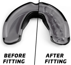 Mouth Guard Sports w/Case, Professional Mouthguard for Boxing, Football, Hockey,