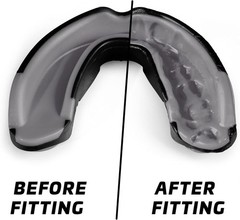 Mouth Guard Sports w/Case Professional Mouthguard for Boxing Football Hockey ..